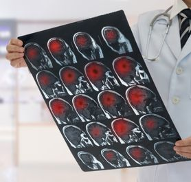 Document for Advanced Stroke Centres Certification Programme